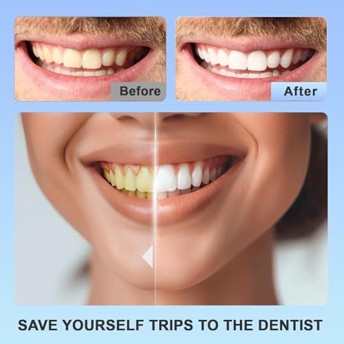 Teeth Whitening Strips 14 Treatments - Whitening Strips Without the Sensitivity - Enamel Safe for Whiter Teeth - Sensitivity Free - 28 Strips (14 Count Pack) O diário de Anne Frank