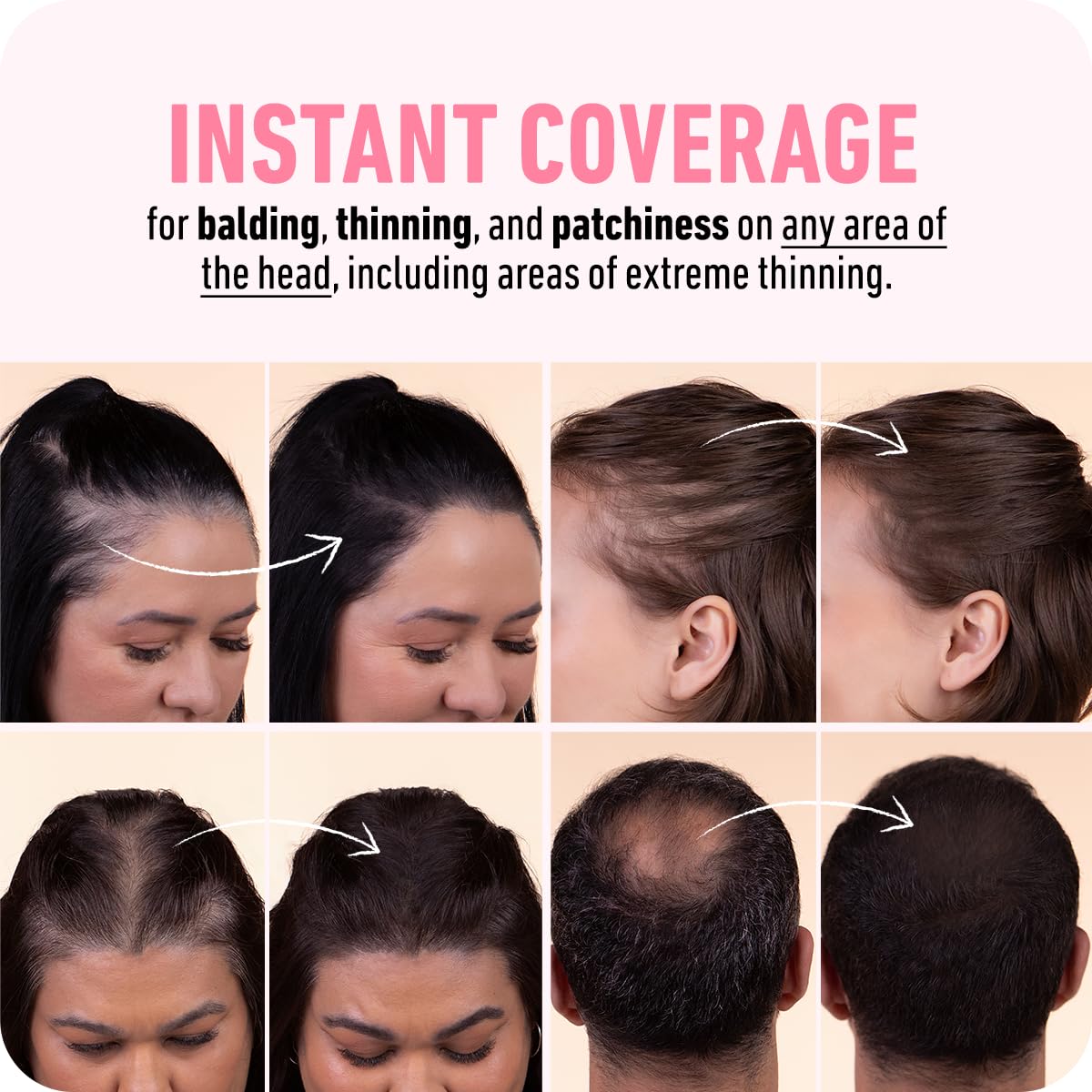 BOLDIFY Hairline Powder (LARGE, 10g) - Root Touch Up Hair Color for Gray Coverage - Bald Spot Concealing Hair Powder for Women & Men - 48-Hour Stain-Proof - Hazel Brown